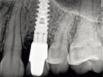 Small ryc 27 opt