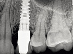 Small ryc 28 opt