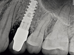 Small ryc 29 opt