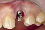 Small ryc 3 opt