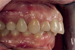 Small ryc 30 opt