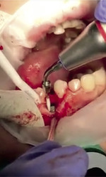 Small ryc 5 opt