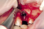 Small ryc 6 opt