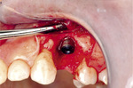 Small ryc 7 opt
