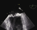 Small 3 opt