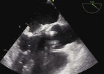 Small 5 opt