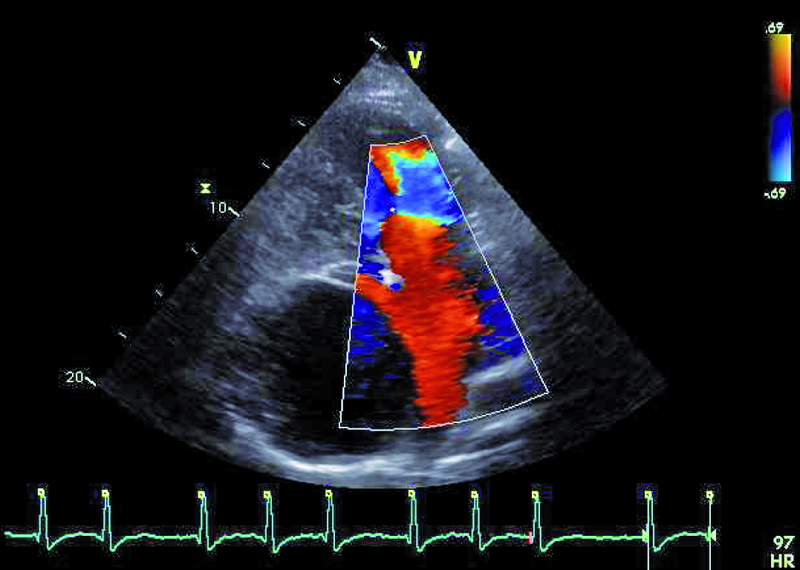 Medium 3