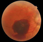 Small obraz94048 opt