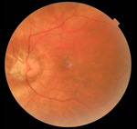 Small obraz94058 opt