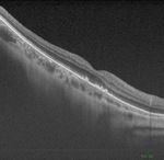 Small obraz94075 opt