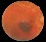 Small obraz94084 opt