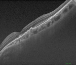 Small obraz94092 opt