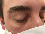 Small obraz94229 opt