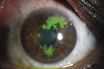 Small oczy 1b opt