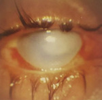 Small oczy 3 opt