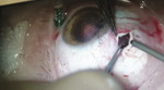 Small oczy 4 opt