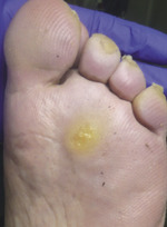 Small derm 147 rycina 1 opt