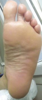 Small derm 147 rycina 10 opt
