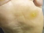 Small derm 147 rycina 12 opt