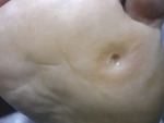 Small derm 147 rycina 13 opt
