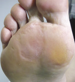Small derm 147 rycina 15 opt