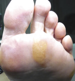 Small derm 147 rycina 2 opt