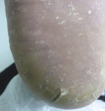 Small derm 147 rycina 3 opt
