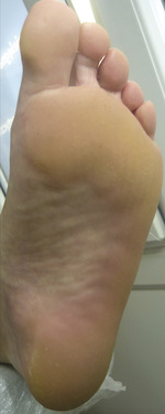 Small derm 147 rycina 4 opt
