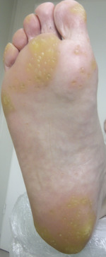 Small derm 147 rycina 5 opt