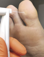 Small derm 147 rycina 9 opt