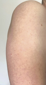 Small derm 146 rycina 1 opt
