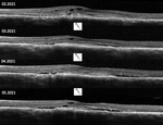 Small obraz97703 opt