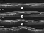 Small obraz97714 opt