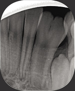 Small ryc. 4 (1) opt