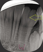 Small ryc. 5 (1) opt