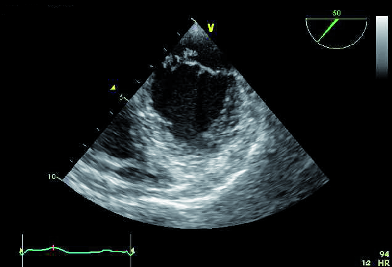 Medium 3