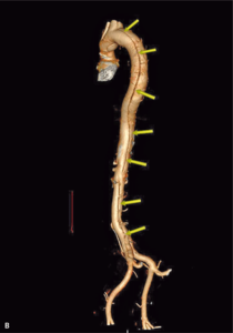 Small ryc.4b