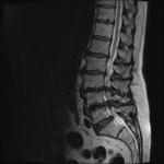 Small obraz83516 opt