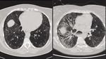 Small derm 190 ryc.4 opt