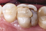 Small 1 opt