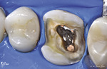 Small 3 opt