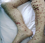 Small derm 193 ryc.1 opt