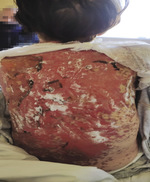 Small derm 193 ryc.2 opt