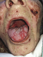 Small derm 193 ryc.3 opt