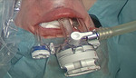 Small ryc2 opt