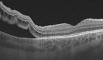 Small laser3 opt