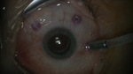 Small obraz79298 opt