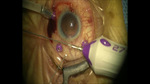 Small obraz79307 opt