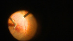 Small obraz79331 opt