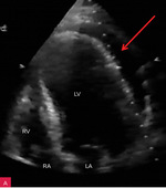 Small 90819
